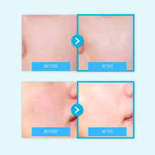 Load image into Gallery viewer, May Young Essential 3-Piece Set (메이영 에센셜 3종 세트)(Good Deal!)