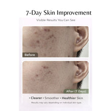 Load image into Gallery viewer, All In One Facial Cleanser Foam 150ml (올인원 클렌저 폼 150ml)